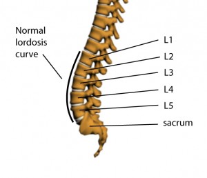Lumbar Spine - Normal Lordosis Curve